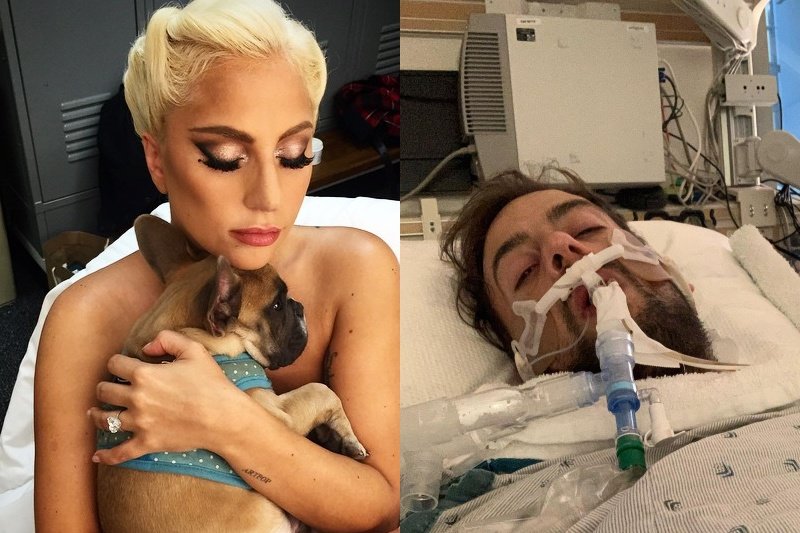 Postrzelony opiekun psów Lady Gagi przemówił ze szpitala. Ryan Fischer wybudził się ze śpiączki