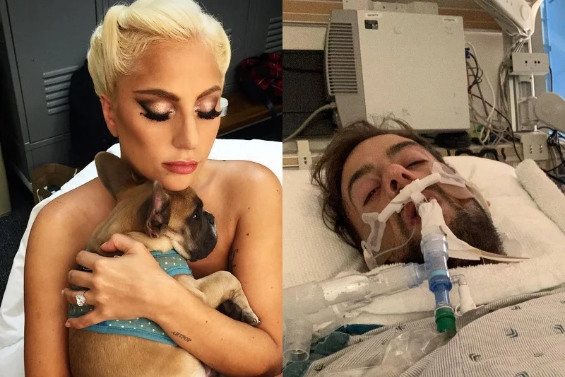 Postrzelony opiekun psów Lady Gagi przemówił ze szpitala. Ryan Fischer wybudził się ze śpiączki